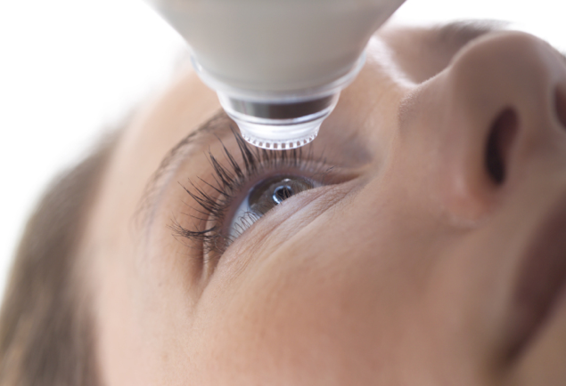 Chirurgie laser de la myopie